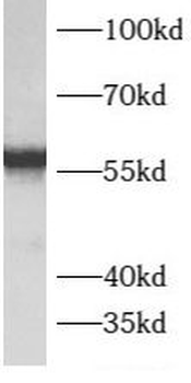 ATP5F1B Rabbit Polyclonal Antibody