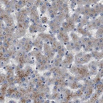 ATP5F1B Rabbit Polyclonal Antibody