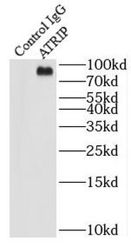 ATRIP Rabbit Polyclonal Antibody