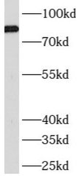 ATRIP Rabbit Polyclonal Antibody