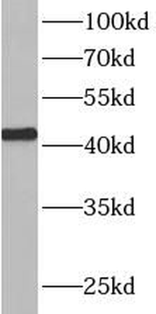 ATXN3L Rabbit Polyclonal Antibody