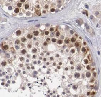 ATXN3L Rabbit Polyclonal Antibody