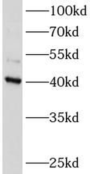 ATXN3L Rabbit Polyclonal Antibody