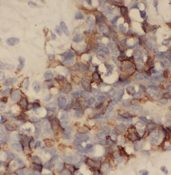 AURKA Rabbit Polyclonal Antibody