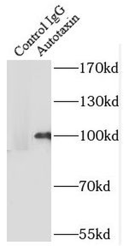 ENPP2 Rabbit Polyclonal Antibody