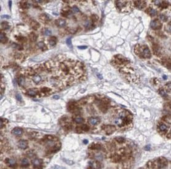 ENPP2 Rabbit Polyclonal Antibody