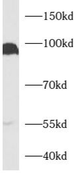 AXIN2 Rabbit Polyclonal Antibody