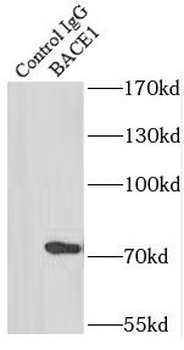 BACE1 Rabbit Polyclonal Antibody