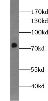 BACE1 Rabbit Polyclonal Antibody