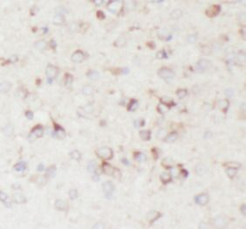 BACE1 Rabbit Polyclonal Antibody