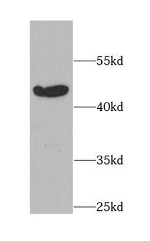 BAG1 Rabbit Polyclonal Antibody