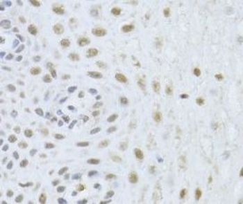 BAG1 Rabbit Polyclonal Antibody
