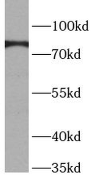 BAG3 Rabbit Polyclonal Antibody
