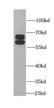 BAIAP2 Rabbit Polyclonal Antibody