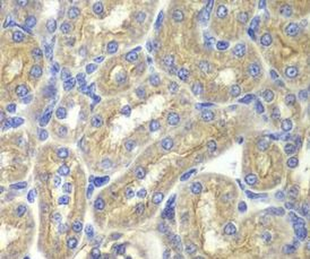 BAIAP2 Rabbit Polyclonal Antibody