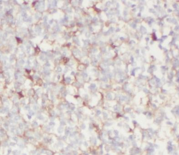 BAK1 Rabbit Polyclonal Antibody