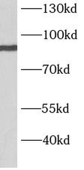 BARD1 Rabbit Polyclonal Antibody