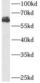 ATG14 Rabbit Polyclonal Antibody