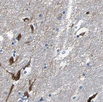 ATG14 Rabbit Polyclonal Antibody