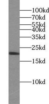 BAX Rabbit Polyclonal Antibody
