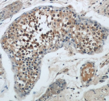 BAX Rabbit Polyclonal Antibody