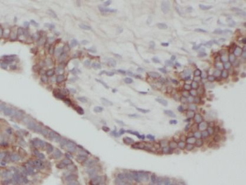 BAX Mouse Monoclonal Antibody