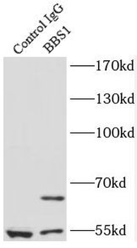 BBS1 Rabbit Polyclonal Antibody