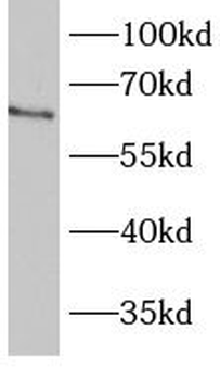 BBS1 Rabbit Polyclonal Antibody
