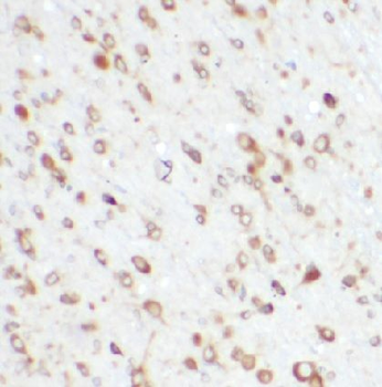 BBS1 Rabbit Polyclonal Antibody