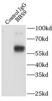 BBS9 Rabbit Polyclonal Antibody