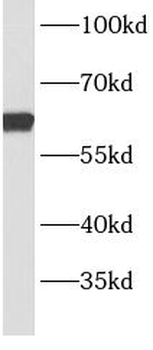 BBS9 Rabbit Polyclonal Antibody