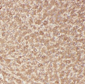 BBS9 Rabbit Polyclonal Antibody
