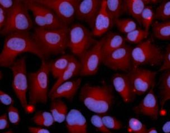BCHE Rabbit Polyclonal Antibody