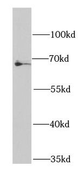 BCHE Rabbit Polyclonal Antibody