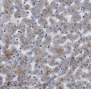 BCHE Rabbit Polyclonal Antibody