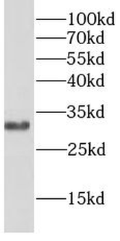 BCL10 Rabbit Polyclonal Antibody