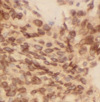 BCL10 Rabbit Polyclonal Antibody