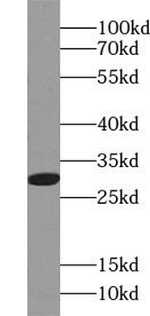BCL10 Rabbit Polyclonal Antibody