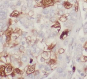 BCL10 Rabbit Polyclonal Antibody