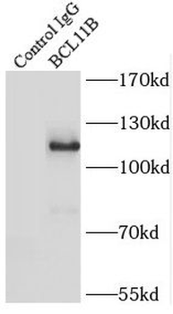 BCL11B Rabbit Polyclonal Antibody