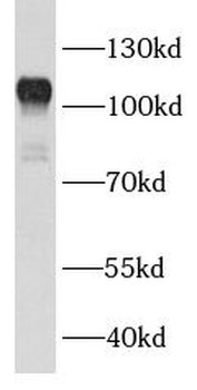 BCL11B Rabbit Polyclonal Antibody