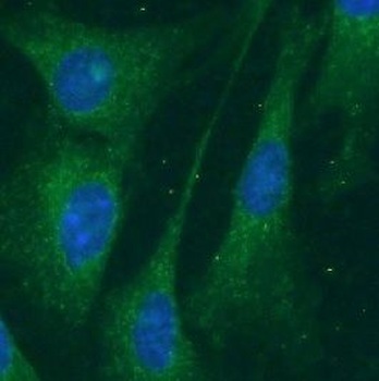 BCL2 Rabbit Polyclonal Antibody