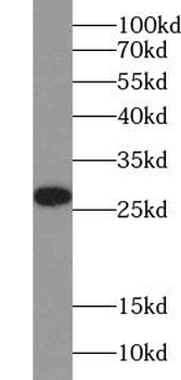 BCL2 Rabbit Polyclonal Antibody