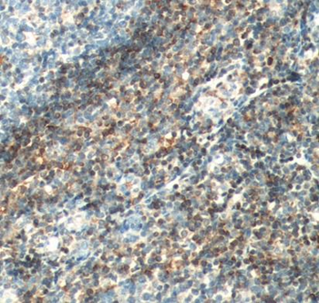 BCL2 Rabbit Polyclonal Antibody