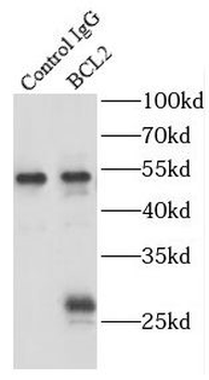 BCL2 Mouse Monoclonal Antibody