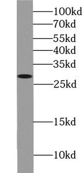 BCL2 Mouse Monoclonal Antibody
