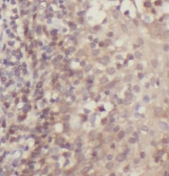 BCL2 Mouse Monoclonal Antibody