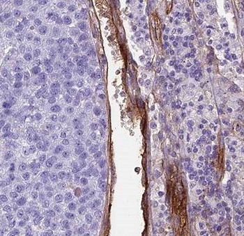BCL2L13 Rabbit Polyclonal Antibody