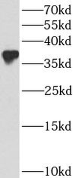 BCL2L14 Rabbit Polyclonal Antibody