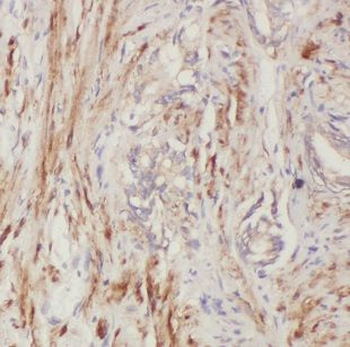 BCL2L14 Rabbit Polyclonal Antibody